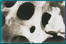 Figure 2. Human Bone (magnified)