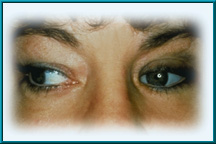 Figure 5. Natural appearance via good condition of the eyelids.