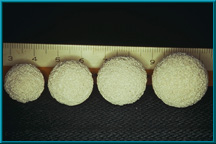 Figure 3. Example of various sizes of Bio-eye implant.